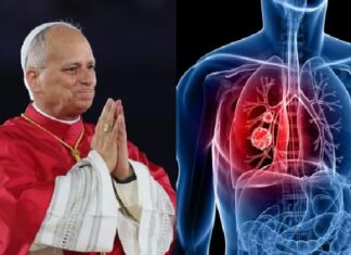 León XIV será internado mañana para su operación por un nódulo pulmonar